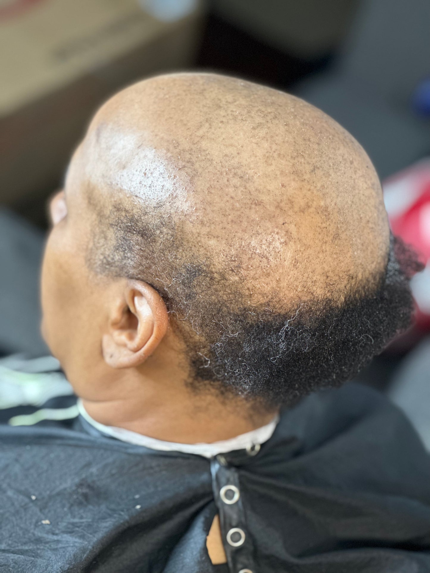 TruNu Scalp By Christina Benjamin “Perfect Pixie” Crown Topper