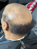 TruNu Scalp by Christina “Ms. Curlz” Spiral Curl Crown Topper”