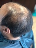 TruNu Scalp by Christina “Ms. Curlz” Spiral Curl Crown Topper”